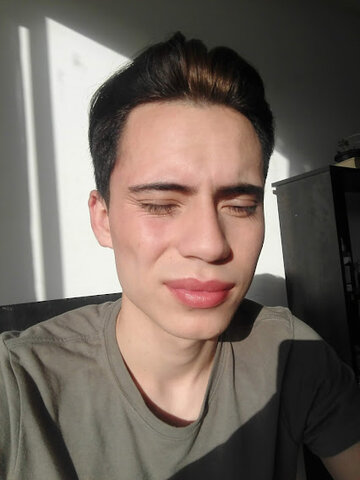 Fue acusado de inyectarse rellenos en los labios