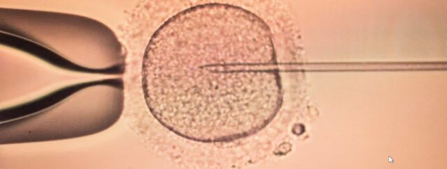 verdens første prøverørsbarn blir født