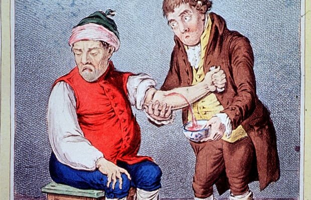 History of Bloodletting