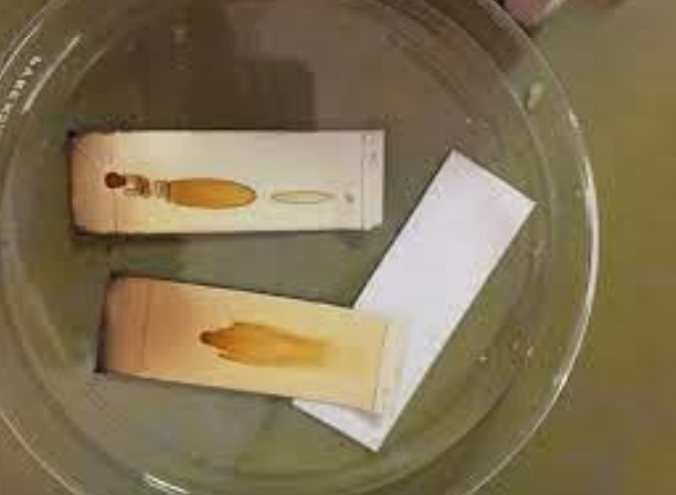 M. Tswett “Cromatografía de un extracto de yema”