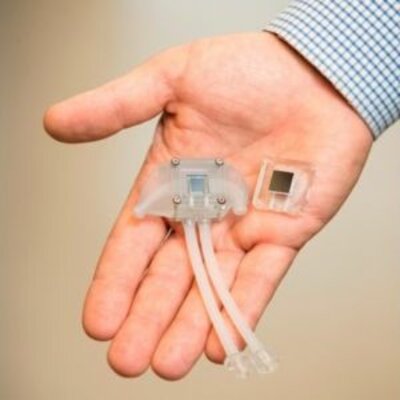 Timeline: Artificial Kidney