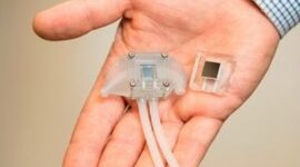 Timeline: Artificial Kidney