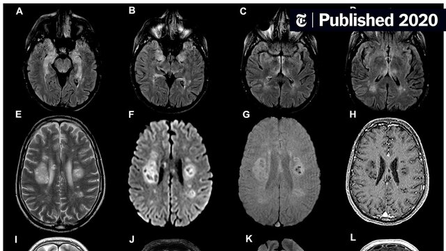 Nuevas tecnologías 1800