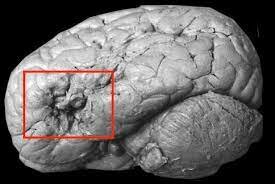 Paul Broca y Carl Wernicke - Neuropsicología del lenguaje-