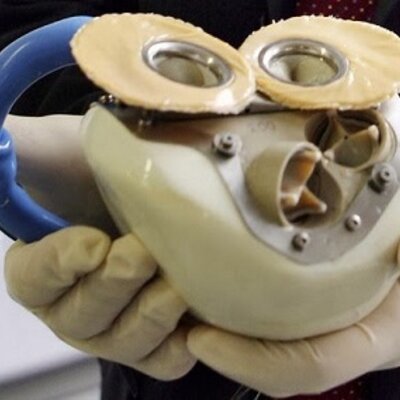 Timeline: The artifical heart