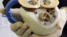 Timeline: The artifical heart