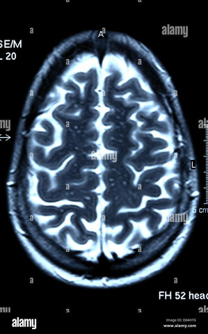 Imágenes Funcionales