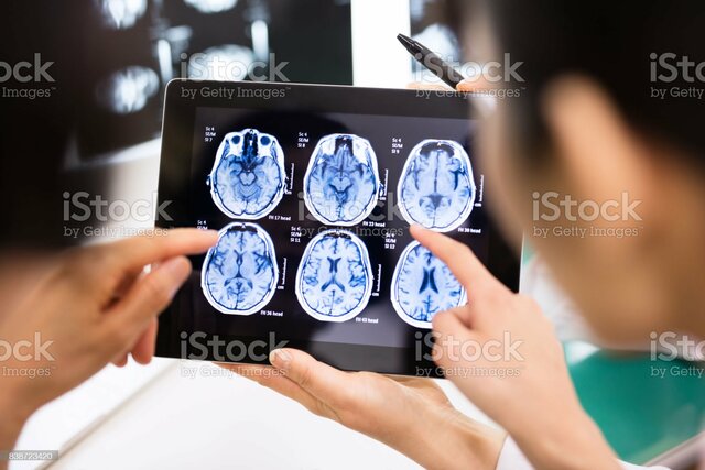 Rehabilitación Neuropsicología.