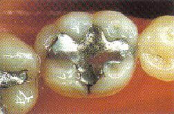 Polvo de plata en mercurio