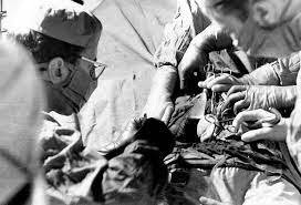 PRIMER TRANSPLANTE DE RIÑON