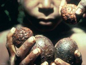 Primeros usos de las plantas toxicas