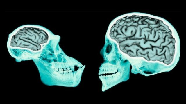 Siglo V a. C Hipótesis cerebral