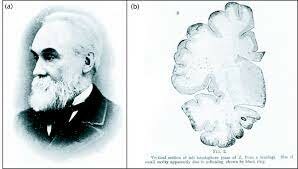 Fundador de la Neurología moderna- John Hughlings-Jackson (1835-1911)