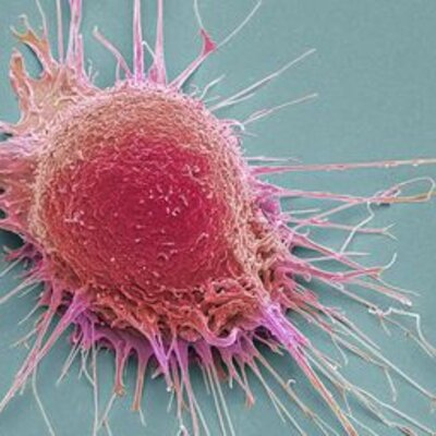 Timeline: Cancer Evolution