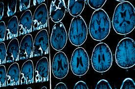 Centro de Investigación en Ciencia del Cerebro y Sociedad, Japón