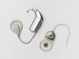 Cochlear implant (bionic ear)