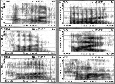 El espectrógrafo analógico de sonido o sonógrafo.