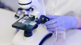 Timeline: Descubrimiento, el desarrollo histórico y avances del microscopio