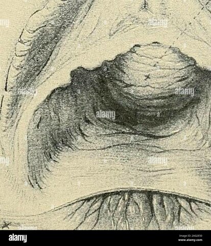 Diagnóstico y tratamiento