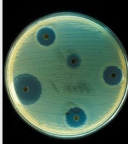 Descubrimiento de la Penicilina 1928