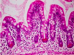 Doble tinción con Hematoxilina eosina (Busch)