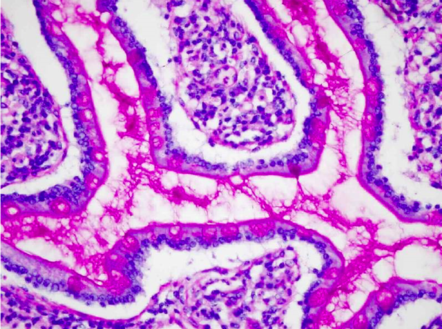 Introducción y resumen de las aplicaciones de la reacción PAS (McManus)