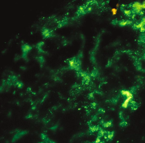Aplicación regular de la inmunofluorescencia