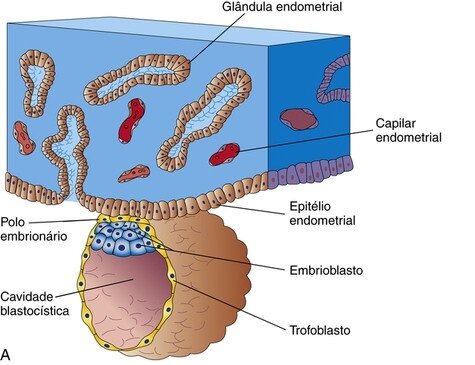 Dia 6 - Início da implantação