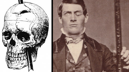 Phineas Gage
