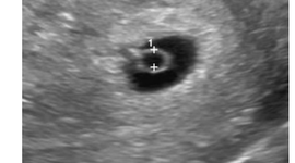 Timeline: 3° e 4° semana do desenvolvimento embrionário