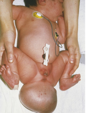 26 dias a 28 dias III