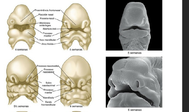 Formação do seio cervical através do segundo arco faríngeo