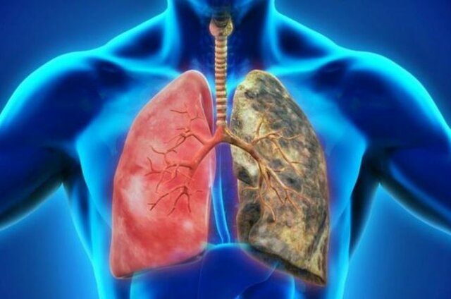 REMODELACIÓN EXPERIMENTAL DE LAS VÍAS RESPIRATORIAS POR SIMVASTATINA