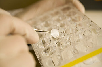 DNA Fingerprinting First Used in Forensic Science.