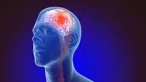 Causas de la muerte de Zela