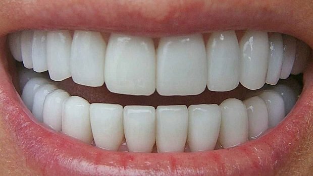 Dientes de mamífero