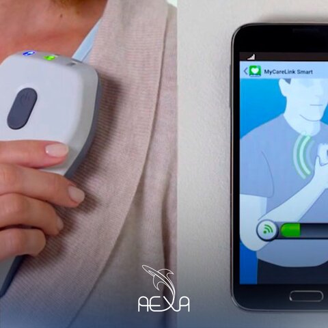 2021  (Marcapasos Conectados a Teléfonos Inteligentes)