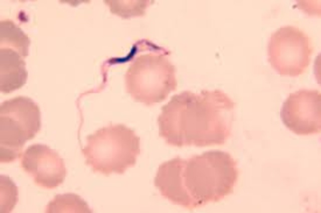 Trypanosomiasis