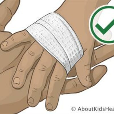 Timeline: CRONOLOGIA DE ATENCION EN QUEMADURAS