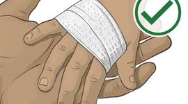 Timeline: CRONOLOGIA DE ATENCION EN QUEMADURAS