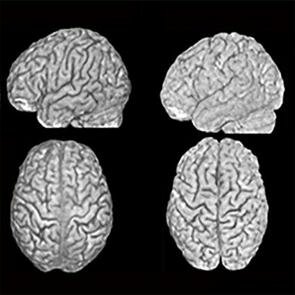 Primer Congreso Mundial de Psiquiatría