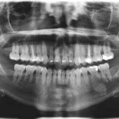 Timeline: HISTORIA DE LA RADIOLOGÍA ORAL Y MAXILOFACIAL