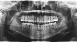 Timeline: HISTORIA DE LA RADIOLOGÍA ORAL Y MAXILOFACIAL