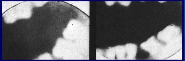 Primera radiografía dental del mundo