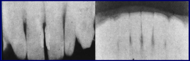 Otras de las primeras radiografías