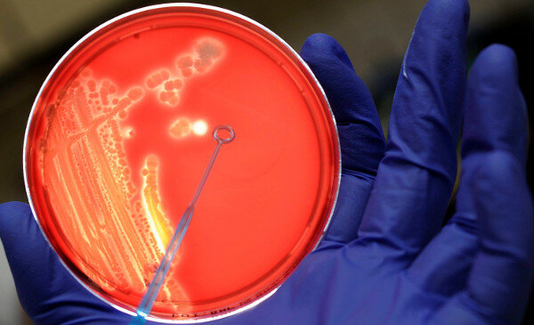 Existencias palmarias patológicas