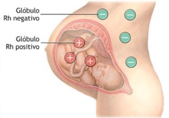 Se descubre la enfermedad Rh
