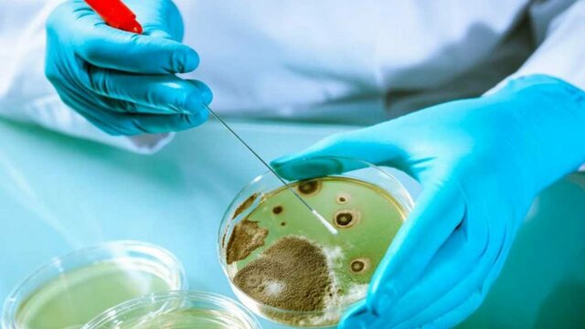 PERIODO ESPECULATIVO DE LA MICROSCOPIA