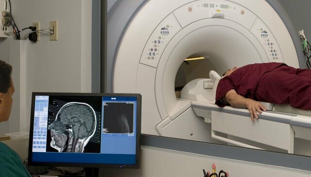 Imagen por Resonancia Magnética (IRM)