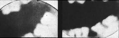 Primera radiografía dental del mundo: 12 enero, 1896